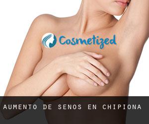 Aumento de Senos en Chipiona Aumento de Senos en Chipiona
