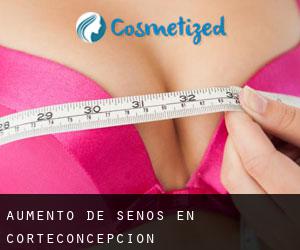 Aumento de Senos en Corteconcepción Aumento de Senos en Corteconcepción