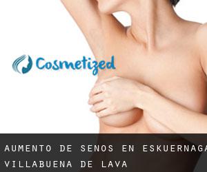 Aumento de Senos en Eskuernaga / Villabuena de Álava Aumento de Senos en Eskuernaga / Villabuena de Álava