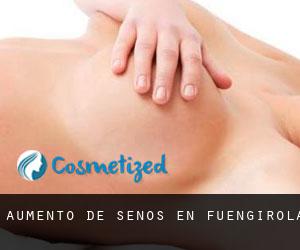 Aumento de Senos en Fuengirola Aumento de Senos en Fuengirola