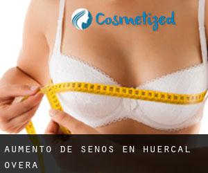Aumento de Senos en Huércal-Overa Aumento de Senos en Huércal-Overa
