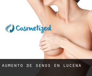 Aumento de Senos en Lucena Aumento de Senos en Lucena