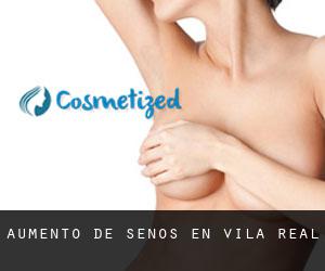 Aumento de Senos en Vila-real Aumento de Senos en Vila-real