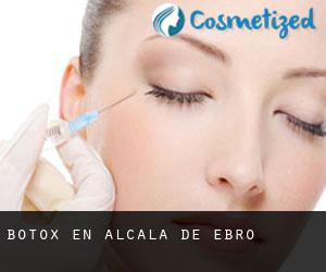 Botox en Alcalá de Ebro