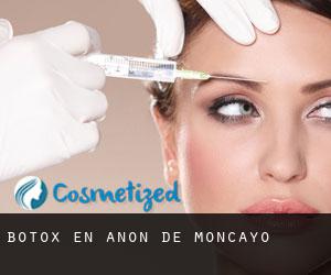 Botox en Añón de Moncayo
