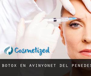 Botox en Avinyonet del Penedès