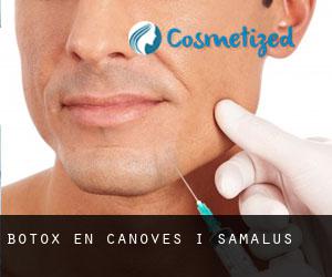 Botox en Cànoves i Samalús
