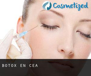Botox en Cea Botox en Cea
