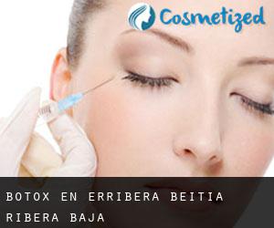 Botox en Erribera Beitia / Ribera Baja