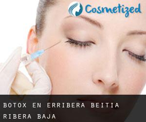Botox en Erribera Beitia / Ribera Baja Botox en Erribera Beitia / Ribera Baja