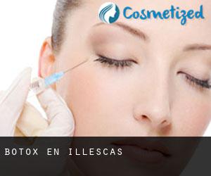 Botox en Illescas