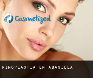 Rinoplastia en Abanilla