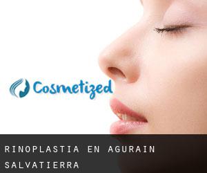 Rinoplastia en Agurain / Salvatierra