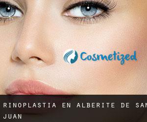 Rinoplastia en Alberite de San Juan Rinoplastia en Alberite de San Juan