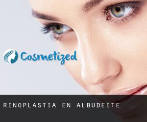 Rinoplastia en Albudeite