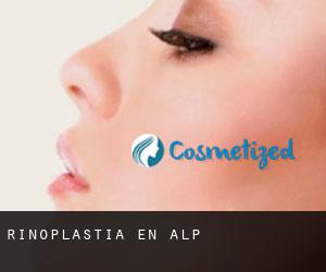 Rinoplastia en Alp Rinoplastia en Alp