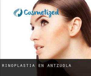 Rinoplastia en Antzuola