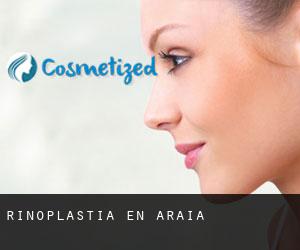 Rinoplastia en Araia Rinoplastia en Araia