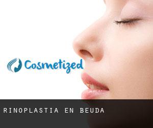 Rinoplastia en Beuda Rinoplastia en Beuda