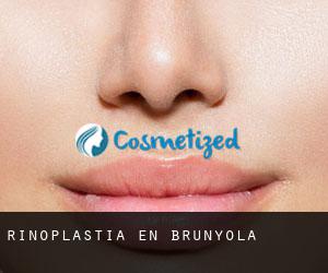 Rinoplastia en Brunyola Rinoplastia en Brunyola