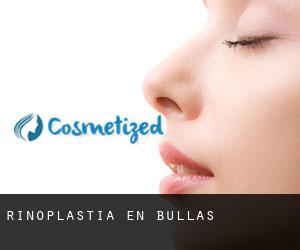Rinoplastia en Bullas Rinoplastia en Bullas