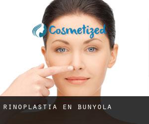 Rinoplastia en Bunyola