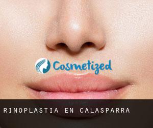 Rinoplastia en Calasparra