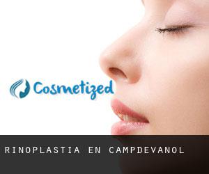 Rinoplastia en Campdevànol Rinoplastia en Campdevànol