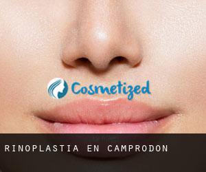 Rinoplastia en Camprodon Rinoplastia en Camprodon