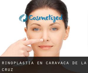 Rinoplastia en Caravaca de la Cruz