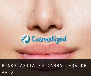 Rinoplastia en Carballeda de Avia Rinoplastia en Carballeda de Avia