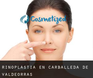 Rinoplastia en Carballeda de Valdeorras Rinoplastia en Carballeda de Valdeorras