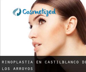 Rinoplastia en Castilblanco de los Arroyos