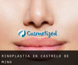 Rinoplastia en Castrelo de Miño Rinoplastia en Castrelo de Miño