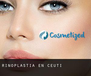 Rinoplastia en Ceuti