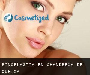 Rinoplastia en Chandrexa de Queixa Rinoplastia en Chandrexa de Queixa