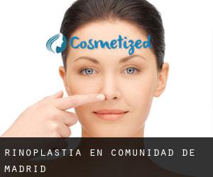 Rinoplastia en Comunidad de Madrid Rinoplastia en Comunidad de Madrid