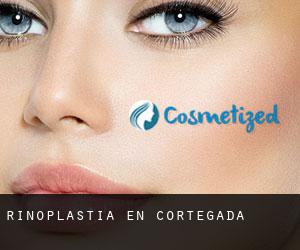 Rinoplastia en Cortegada Rinoplastia en Cortegada