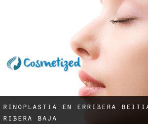 Rinoplastia en Erribera Beitia / Ribera Baja