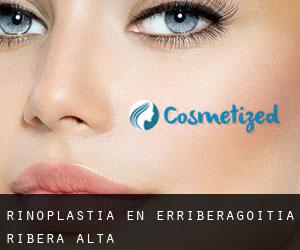 Rinoplastia en Erriberagoitia / Ribera Alta