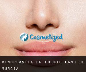 Rinoplastia en Fuente-Álamo de Murcia Rinoplastia en Fuente-Álamo de Murcia