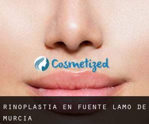 Rinoplastia en Fuente-Álamo de Murcia