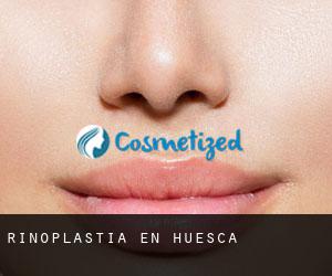 Rinoplastia en Huesca