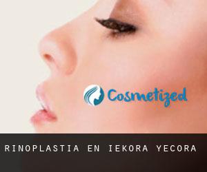 Rinoplastia en Iekora / Yécora