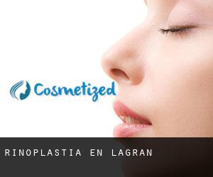 Rinoplastia en Lagrán Rinoplastia en Lagrán