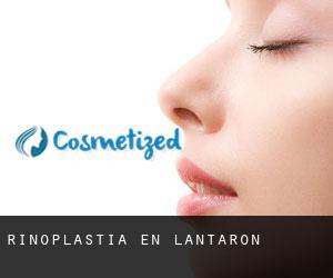 Rinoplastia en Lantarón Rinoplastia en Lantarón
