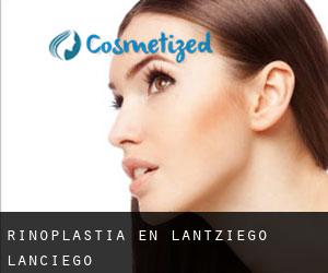 Rinoplastia en Lantziego / Lanciego