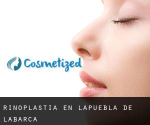 Rinoplastia en Lapuebla de Labarca Rinoplastia en Lapuebla de Labarca