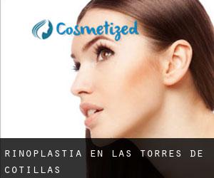 Rinoplastia en Las Torres de Cotillas