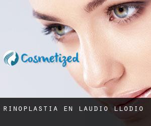 Rinoplastia en Laudio / Llodio Rinoplastia en Laudio / Llodio